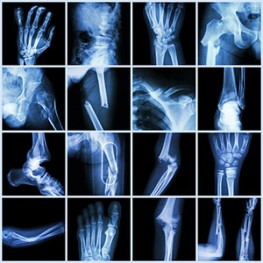 Bone