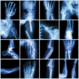 Bone