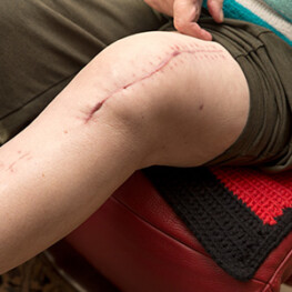 Scar